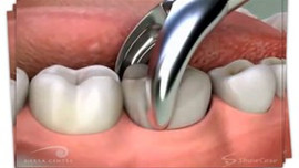 Dişini çektirdi!  Öldü!