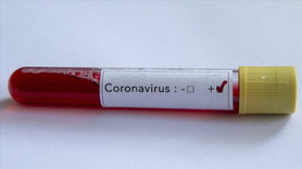 Almanya'da günde 200 bin koronavirüs testi yapacak